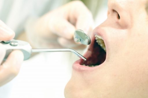 歯科医院で口臭治療を受ける女性